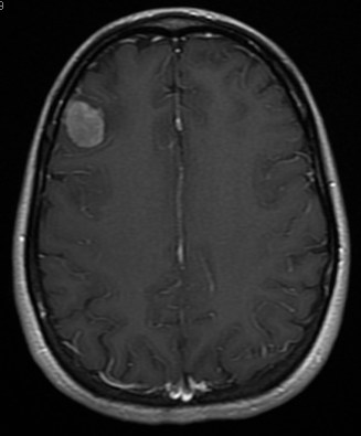 Fig. 1 - My brains.